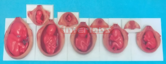 UTERUS WITH EMBRYO